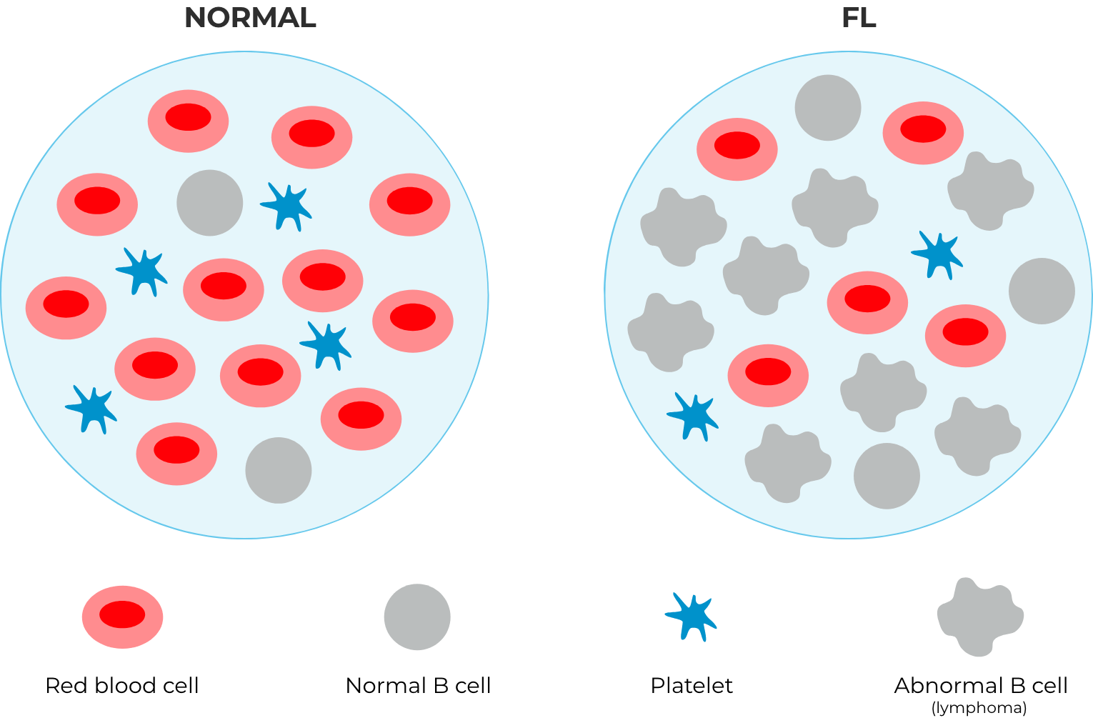 Normal cells vs FL cancer cells